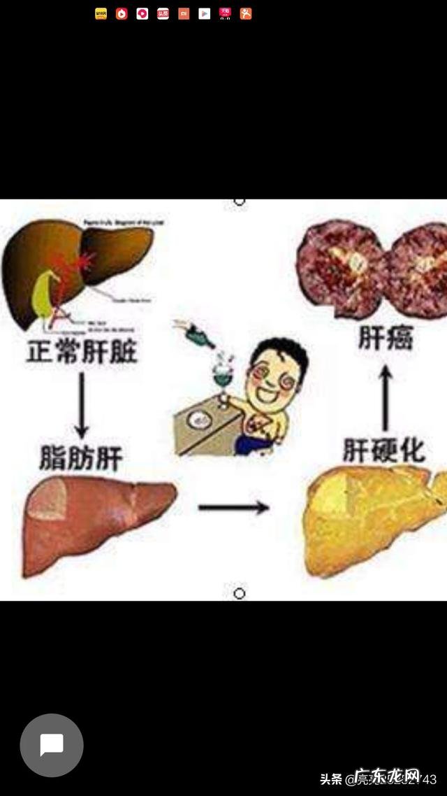 中度脂肪肝,每天快走五公里,一周休息一天,能逆转吗? 每天快走四十分钟能减掉脂肪肝吗