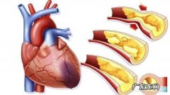 甘油三酯2.02算高吗？