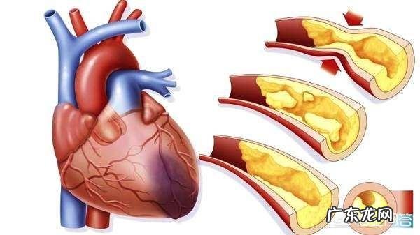 甘油三酯2.02算高吗?