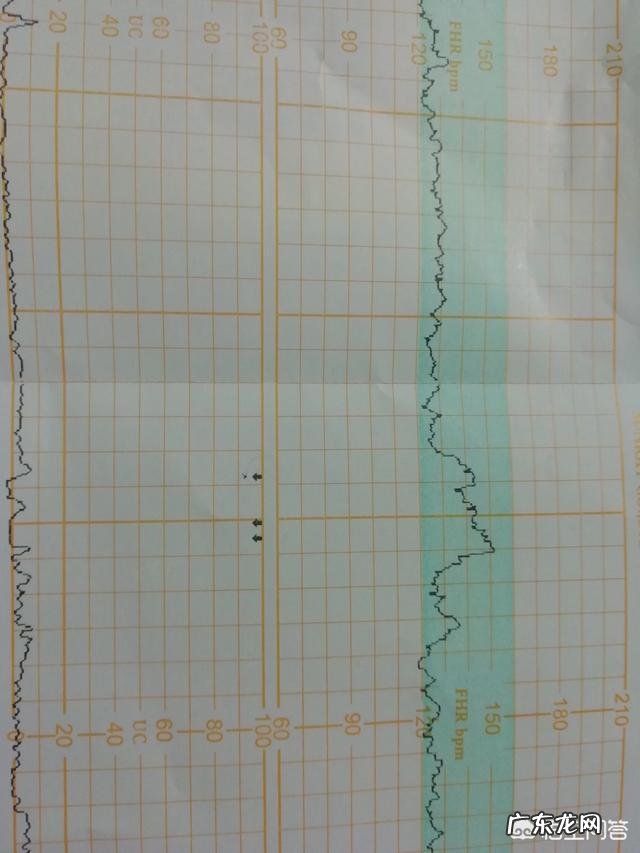 我怀孕两个多月口水太多了好烦呀?