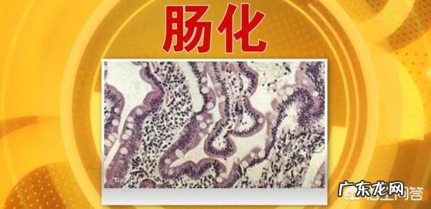 为什么萎缩糜烂性胃炎不仅感觉胃不舒服胸还会痛?