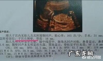 怀孕12周做b超为什么胎儿不动呢