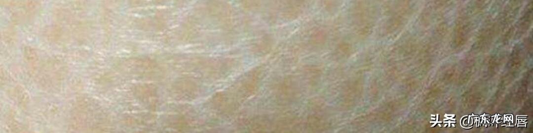 明明自己做好了护肤保养为何肌肤还会不断脱皮?