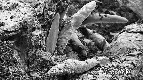 有些人总是在早上起床时发现脸上长痘,是什么原因?