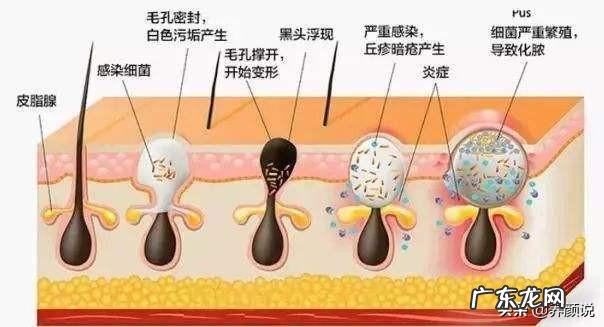 深层洁面控油洗面奶 日常深层洁面洗面奶哪个好?