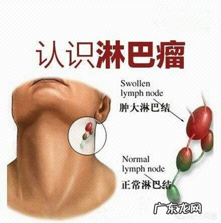 淋巴癌经过化疗可以zhi愈吗