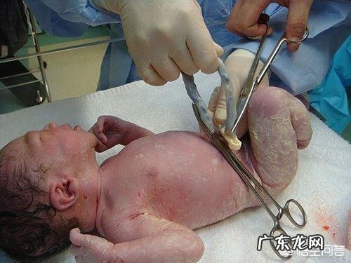 新手妈妈：产后肚子松松垮垮，如何快速恢复如初？