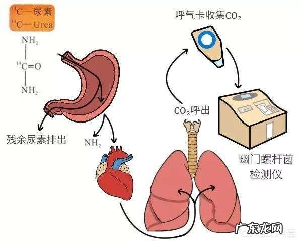 幽门螺杆菌对人体有什么作用