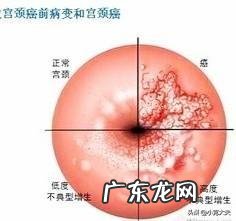 我每天焦虑抑郁,怎么办?