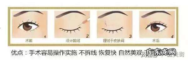 殷桃双眼皮是割的吗 割双眼皮的时候你还是盲目跟风吗