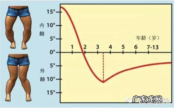 如果宝宝o 型腿怎么办 宝宝有点O型腿,怎么办?