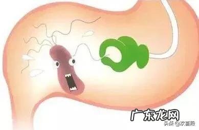 幽门螺旋杆菌有多可怕,会不会导致胃癌呢