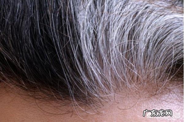 难道除了染发,我们对白发就没有任何办法了吗