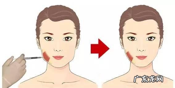 打瘦脸针会有什么后遗症吗?