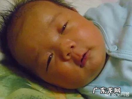 我的宝宝出生都一个月了,黄疸还是没退,会不会影响智力?