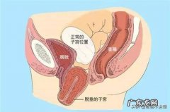 哺乳期的妈妈如何防止子宫下垂，臀部变宽？收腹能达到效果吗？