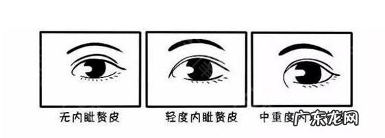 做双眼皮能扩大眼睛吗 双眼皮手术可以改善眼睛吗