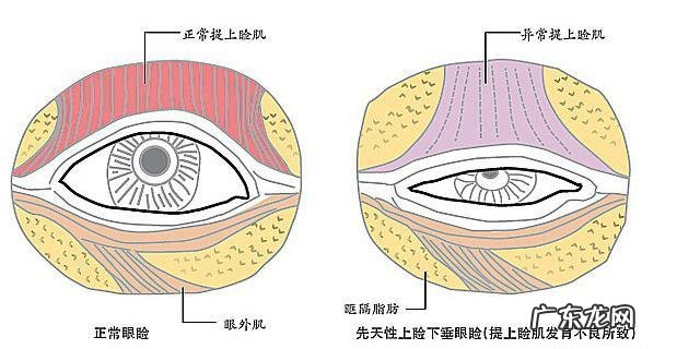 做双眼皮能扩大眼睛吗 双眼皮手术可以改善眼睛吗