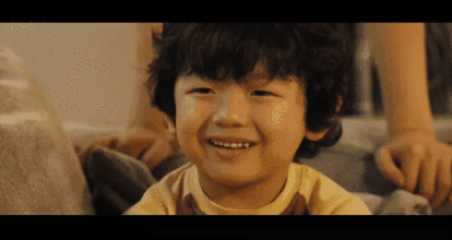 做双眼皮手术全过程真人 做双眼皮手术要了解哪些