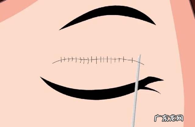 好看的双眼皮效果图 为何双眼皮越深越好看呢