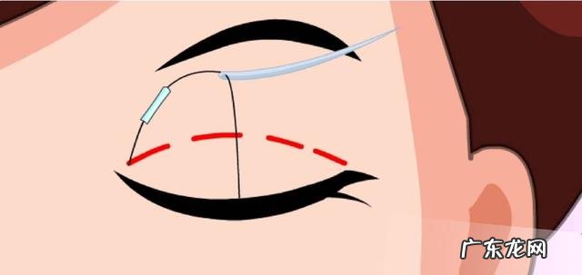 好看的双眼皮效果图 为何双眼皮越深越好看呢