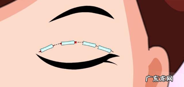 好看的双眼皮效果图 为何双眼皮越深越好看呢