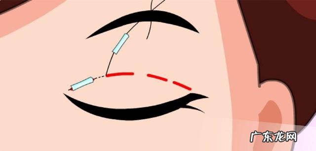 好看的双眼皮效果图 为何双眼皮越深越好看呢