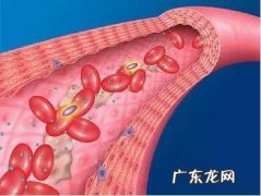 日常如何养护血管，预防脑梗？