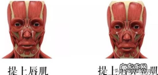 玻尿酸填充法令纹几天有效果？