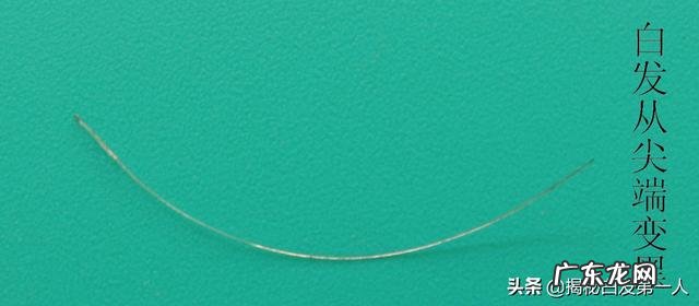 经常出现白发和哪些因素有关