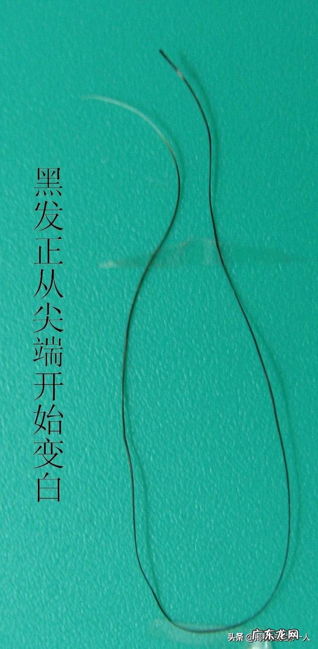 经常出现白发和哪些因素有关