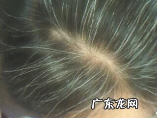 经常出现白发和哪些因素有关