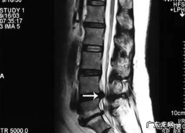 站立半小时左右腰部就开始酸痛是什么原因?