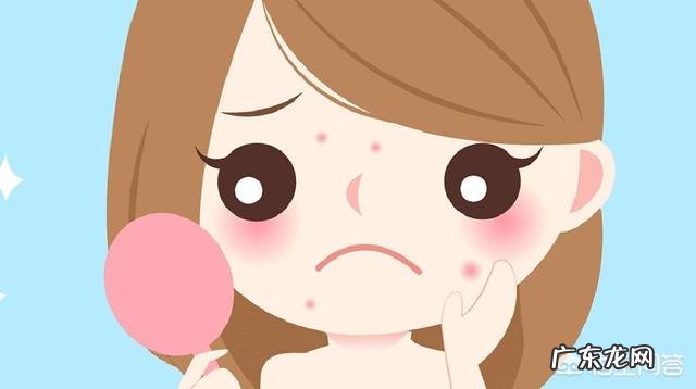 我的脸爱长痘,而且每次还会留痘印,怎么办呢