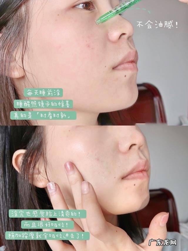 我的脸爱长痘,而且每次还会留痘印,怎么办呢