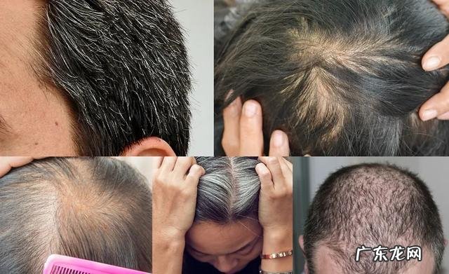 中老年人洗头发的禁忌 老人洗头护发注意事项