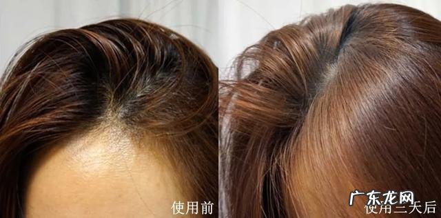 中老年人洗头发的禁忌 老人洗头护发注意事项