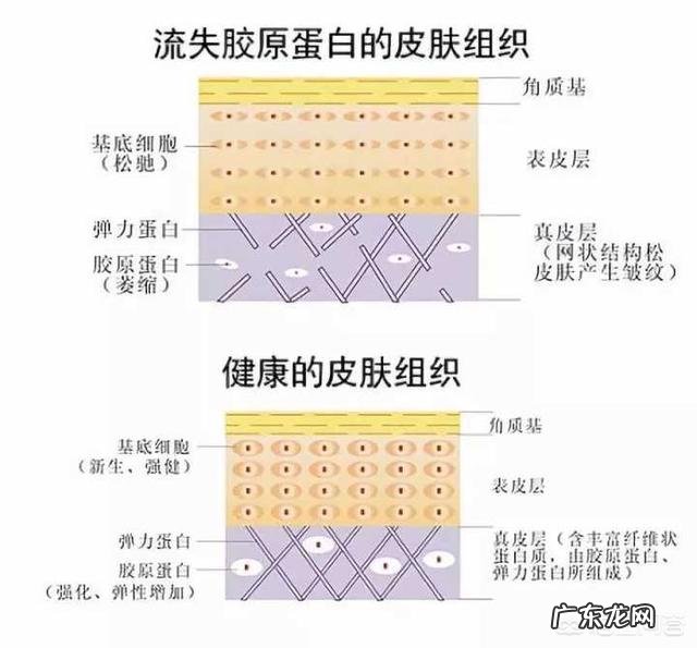 法令纹填充后效果明显吗?