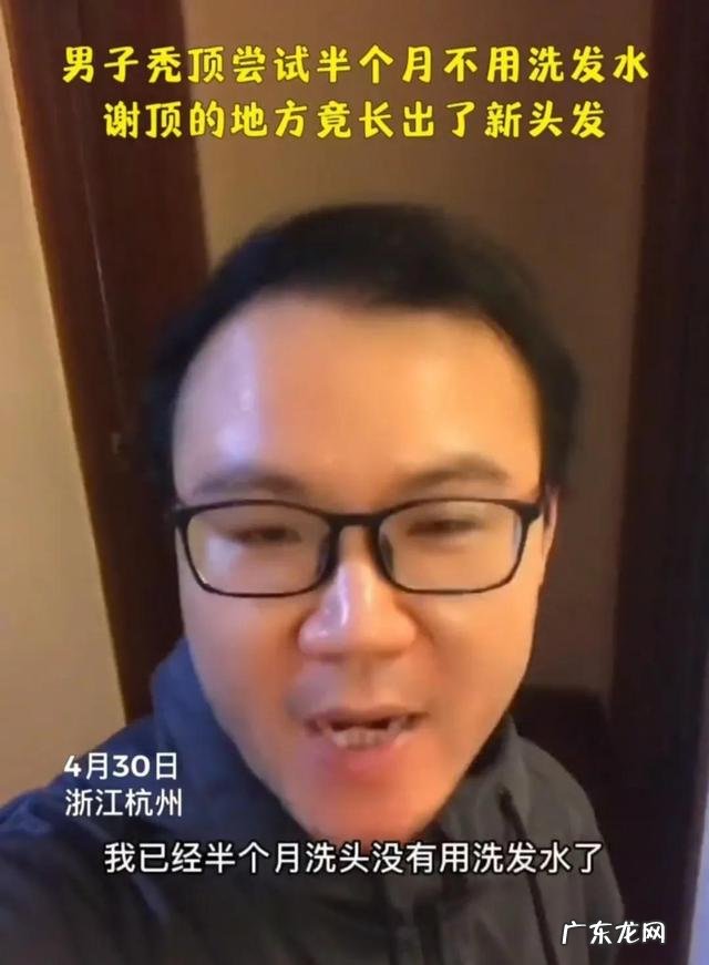 治疗秃头的洗发水 秃头头发稀少用什么洗发水