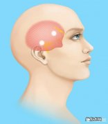 右耳朵侧面偏头痛是什么原因？