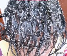 用清水洗头发能改善脱发吗 清水洗头治脱发