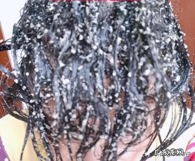 用清水洗头发能改善脱发吗 清水洗头治脱发