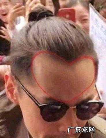 发际线救星洗发水 什么洗发水可以拯救发际线