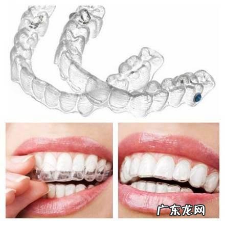 带牙套后怎么保证饮食健康?