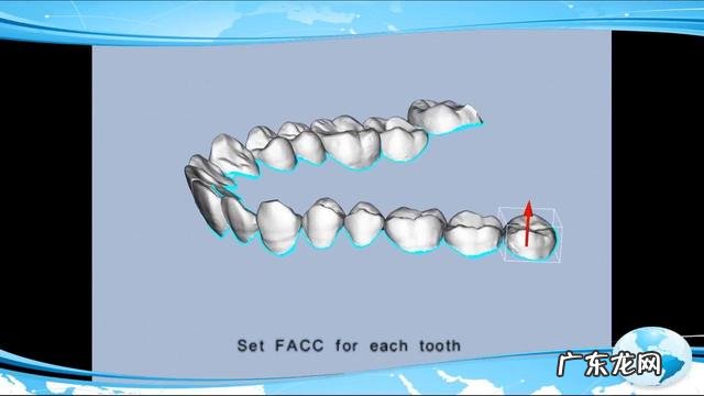 带牙套后怎么保证饮食健康?