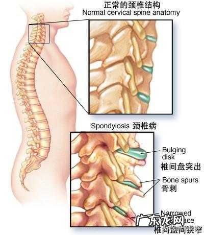 更年期得的颈椎病吃什么药好一些?