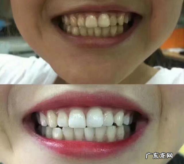 15岁的女孩可以用一些美白或者淡斑的产品吗？