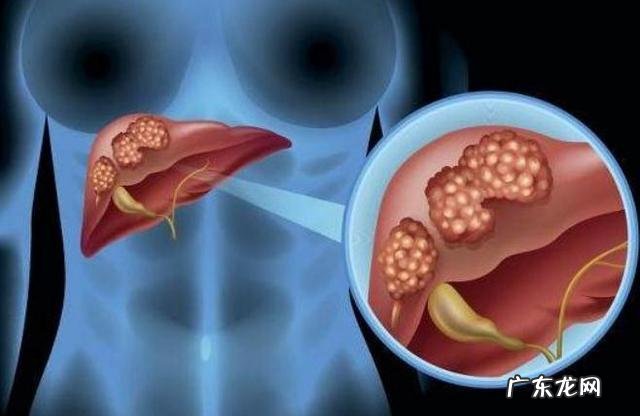 肝炎可以通过中药来调理改善吗?