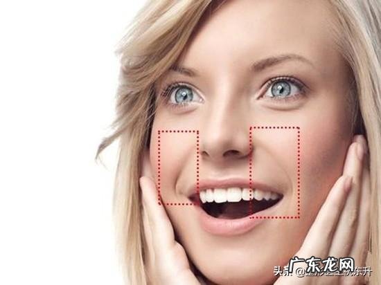 玻尿酸去法令纹可以维持多长时间？