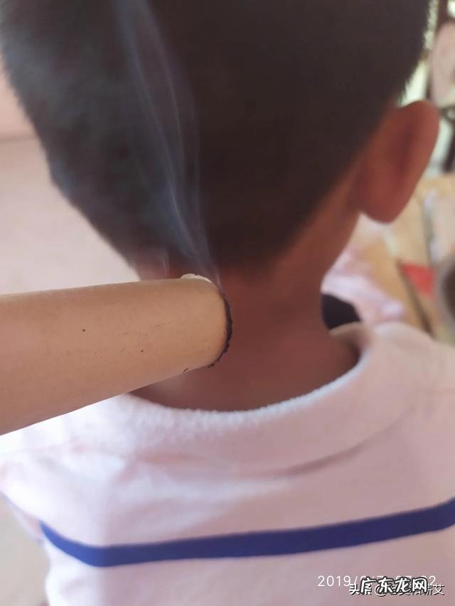 艾灸要不要开穴和封穴?有什么依据吗?